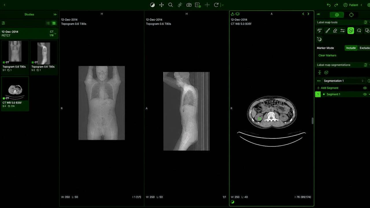 Supacognition app — patient study list