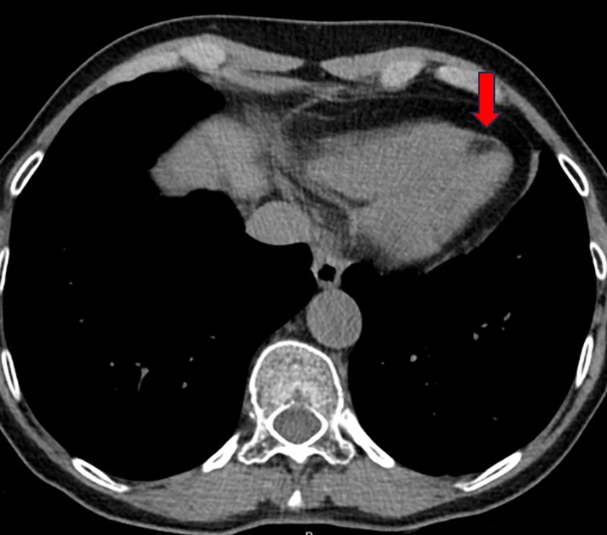 Tumor lesion sizing — main view